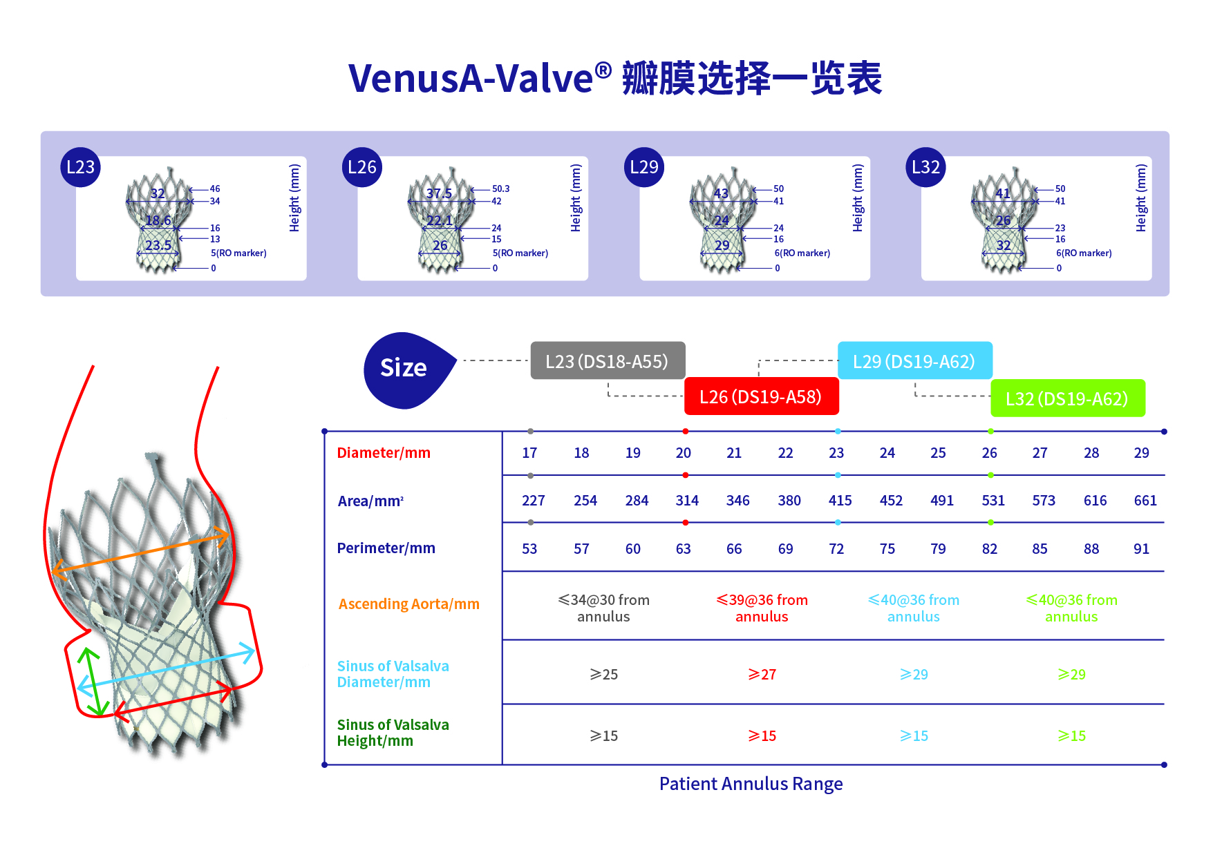 J-Valve介入人工生物心脏瓣膜系统